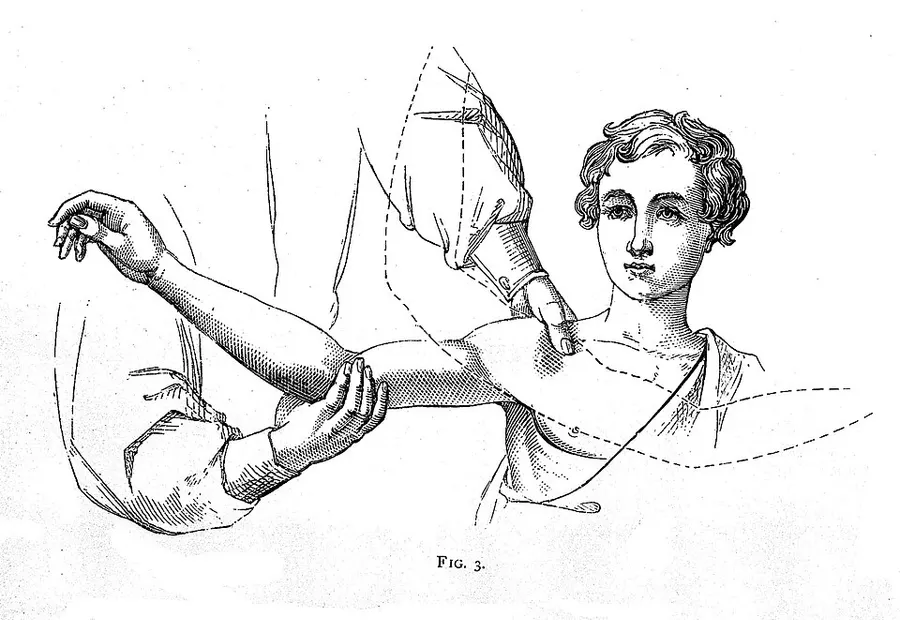 Chinese Bone Setting — traditional medicine archive piece